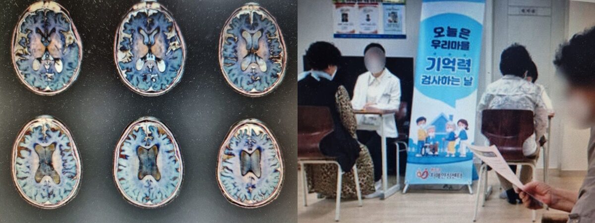 치매 기억력.jpg